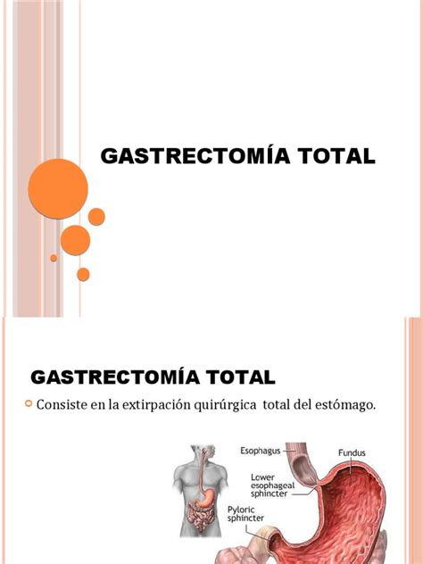 gastrectomia total-4